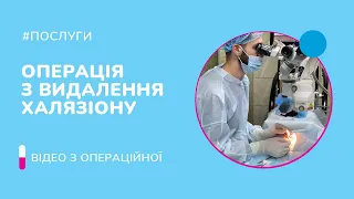 Операция по удалению халязиона в медцентре "ОКО"