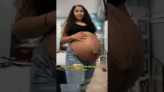 O que SAIU da BARRIGA dessa MULHER deixou todos surpresos!