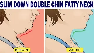 SLIM DOWN DOUBLE CHIN & FATTY NECK (WITH FAST VIDEO SPEED) - Dr Alan Mandell, DC