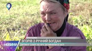 Дворічний хлопчик згорів на Херсонщині