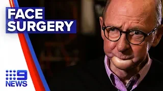 Hey Hey It’s Saturday comedian to undergo reconstructive face surgery | Nine News Australia