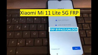 Xiaomi Mi 11 Lite 5G FRP LOCK BYPASS Without PC 🔥 Mi 11 Lite 5G Miui 12.5.5 Google Account FRP LOCK