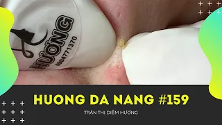 #159 | Huong Da Nang