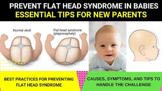 PREVENT FLAT HEAD SYNDROME IN BABIES: ESSENTIAL TIPS FOR PARENTS | HOW TO AVOID FLAT HEAD IN BABIES