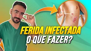 INFECÇÃO NA FERIDA: COMO IDENTIFICAR E TRATAR DA FORMA ADEQUADA!