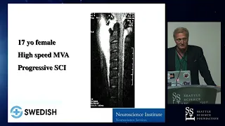 Upper Cervical Spine Trauma - Jens R. Chapman, M.D.