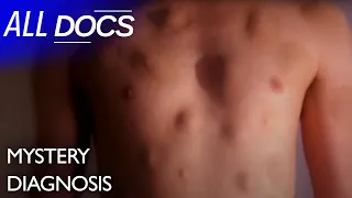 The Man with Hundreds of Lumps | S09 E03 | Medical Documentary | All Documentary