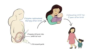 UCSF In Utero Enzyme Replacement Therapy Clinical Trial