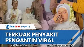 Viral Karena Dirias Sembari Tidur, Malangnya Nasib Pengantin Ini, Meninggal Berselang 12 Hari Nikah