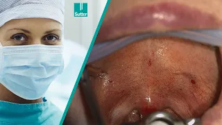 RF Assisted Surgery & RaVoR™ of the Soft Palate | RF-assistierte Chirurgie & RaVoR™ des Weichgaumens