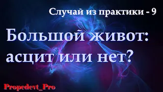 Большой живот: асцит или нет?