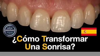 ¿Cómo transformar una sonrisa corrigiendo la forma e inclinación de los dientes?