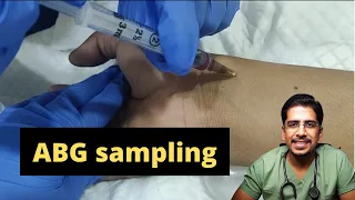 ABG sampling- How & when to do it !!