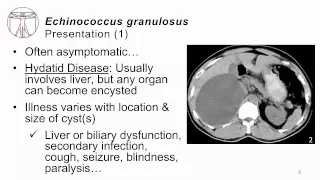 Helminths E granulosus