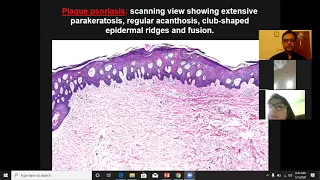 Lecture 4: Dermatopathology; Psoriasiform and Spongiotic dermatoses