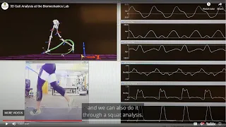 3D Gait Analysis at the Biomechanics Lab