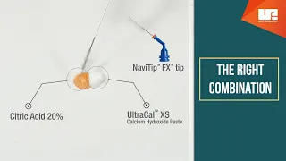 NaviTip™ Tips + UltraCal™ XS and Citric Acid | Made For Each Other