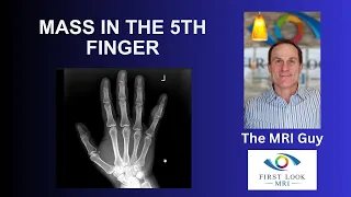 Mass in 5th finger