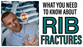 RIB FRACTURES: What To Know and What To Do | Aleks Physio