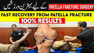 Physiotherapy Session, Exercises &Rehabilitation for Patella Fracture Surgery at Home | Urdu & Hindi