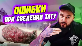 Как нельзя удалять татуировку? / Самые распространённые ошибки при сведении тату