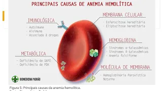 Aula Anemia normocítica e normocrômica