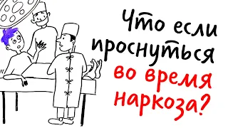 Что, если ПРОСНУТЬСЯ во время ОПЕРАЦИИ? — Научпок