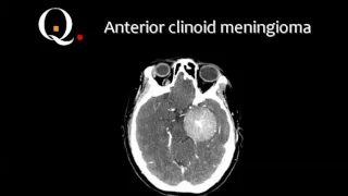 Quiz Brain part II  Aug 2014  Dr Mamdouh Mahfouz In Arabic 720p