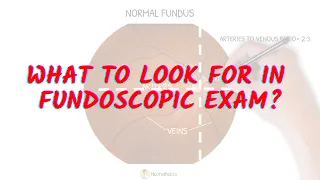 What to look for in fundoscopic exam Neuroaholics