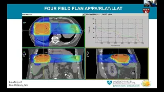 Dr Jennifer Wo: Proton Therapy in Gastrointestinal Cancers: Better Outcomes or Just More Costly?