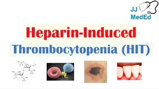 Heparin-Induced Thrombocytopenia (HIT) | Types, Signs & Symptoms, Diagnosis, Treatment