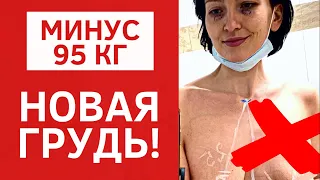 СЛОЖНАЯ ПОДТЯЖКА ГРУДИ С ИМПЛАНТАМИ | ОТКРОВЕННО ИЗ ОПЕРАЦИОННОЙ |  МАММОПЛАСТИКА ПОСЛЕ ПОХУДЕНИЯ