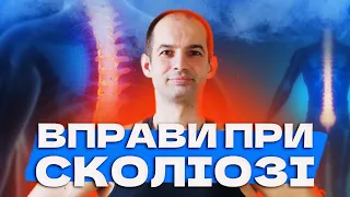 Вправи при сколіозі, Зміцнюємо м'язи спини, Кращий комплекс вправ