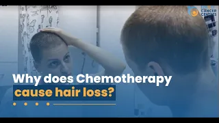 Why does Chemotherapy cause hair loss | FAQ English | Onco Cancer Care