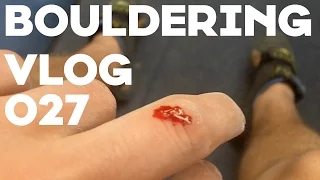 Bouldering Progress Vlog 027 - A Bloody Mistake!