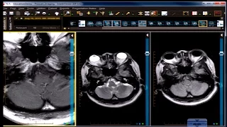 Neuro Imaging Board and Recredentialing Review 12