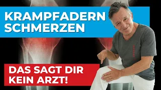 Bei Krampfadern und Schmerzen - Das sagt dir kein Arzt! 🍀