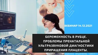 Беременность в рубце. Проблемы пренатальной ультразвуковой диагностики. Вебинар 14.12.2021