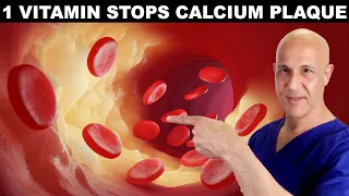 1 Vitamin STOPS Calcium Plaque in Arteries & Heart | Dr. Mandell