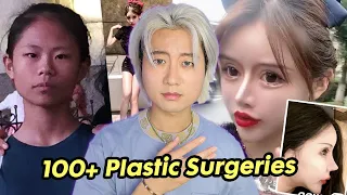 The Youngest Plastic Surgery Influencer at 16