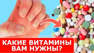 Каких витаминов вам не хватает? Организм кричит о помощи! Главные признаки дефицита микроэлементов