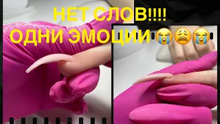 Ногтям 10 дней!!!! Работа от другого мастера!!!!