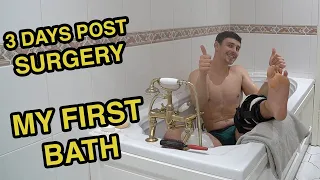 How to Have a Bath After ACL Surgery