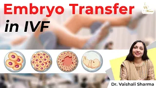 ✅Embryo Transfer | IVF Embryo Transfer Success Symptoms | Day 3 or Day 5 Embryo Transfer