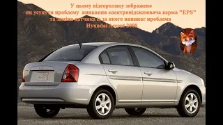 Усуненя ошибки вимкнення ESP  Hyundai Accent 2008-2011 року, вимкнення електропідсилювача  кервма