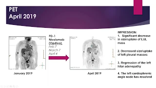 May 2020: Topics in Cardio Oncology Webinar