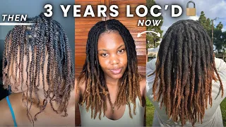 3 Year Loc Journey: Regrets, Ugly Phase, Shrinkage, Psoriasis, Locticians - A Detailed Update!