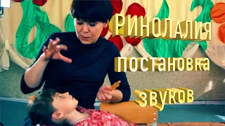 Ринолалия | Запуск речи | Постановка звуков | Ваш ребенок не говорит