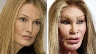 10 Plastic Surgery Horrible Stories