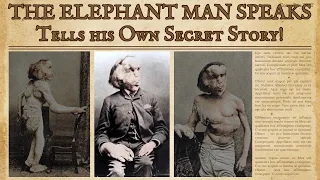 The Elephant Man Speaks! Tells his Own Secret Story! #history #historyfacts